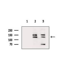 Invitrogen ARHGAP20 Polyclonal Antibody 100 &mu;L; Unconjugated:Antibodies,