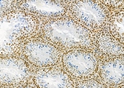 Invitrogen ARHGAP23 Polyclonal Antibody 100 &mu;L | Buy Online | Invitrogen&trade; | Fisher Scientific