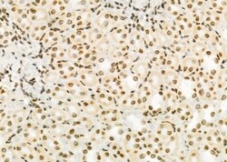 Invitrogen ARHGAP23 Polyclonal Antibody 100 &mu;L | Buy Online | Invitrogen&trade; | Fisher Scientific