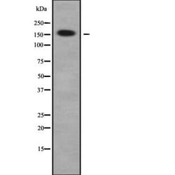 Invitrogen ARHGAP23 Polyclonal Antibody 100 &mu;L | Buy Online | Invitrogen&trade; | Fisher Scientific