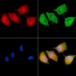 Invitrogen ARHGAP6 Polyclonal Antibody 100 &mu;L; Unconjugated:Antibodies,