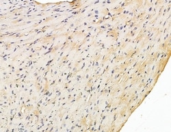 Invitrogen ARHGAP6 Polyclonal Antibody 100 &mu;L; Unconjugated:Antibodies,