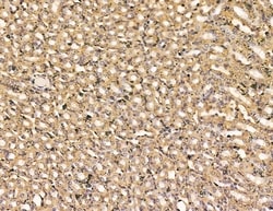 Invitrogen ARHGAP6 Polyclonal Antibody 100 &mu;L; Unconjugated:Antibodies,