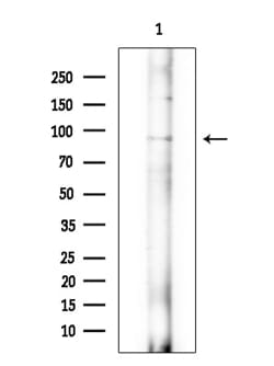 Invitrogen ARHGAP6 Polyclonal Antibody 100 &mu;L; Unconjugated:Antibodies,