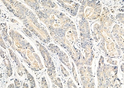 Invitrogen ARHGEF6 Polyclonal Antibody 100 &mu;L; Unconjugated:Antibodies,