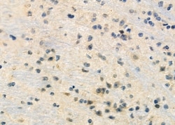 Invitrogen RPL22/RPL22L1 Polyclonal Antibody 100 &mu;L; Unconjugated:Antibodies,