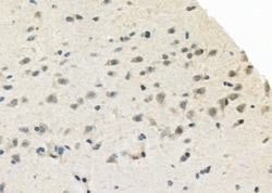 Invitrogen RPL22/RPL22L1 Polyclonal Antibody 100 &mu;L; Unconjugated:Antibodies,