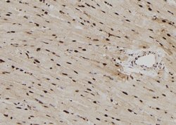 Invitrogen RPS6KL1 Polyclonal Antibody 100 &mu;L; Unconjugated:Antibodies,