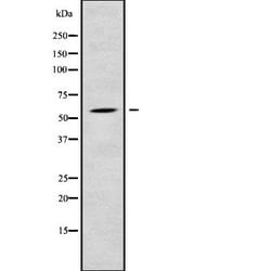 Invitrogen RPS6KL1 Polyclonal Antibody 100 &mu;L; Unconjugated:Antibodies,