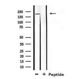 Invitrogen CROCC Polyclonal Antibody 100 &mu;L; Unconjugated:Antibodies,