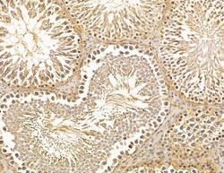 Invitrogen SCARA3 Polyclonal Antibody 100 &mu;L; Unconjugated:Antibodies,
