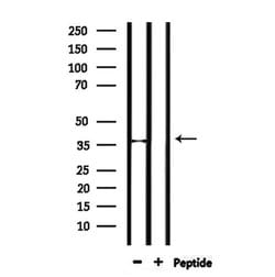 Invitrogen FRZB Polyclonal Antibody 100 &mu;L; Unconjugated:Antibodies,