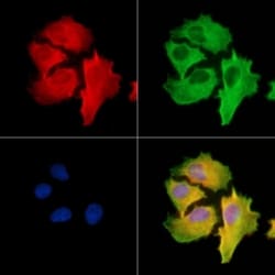 Invitrogen STK31 Polyclonal Antibody 100 &mu;L; Unconjugated:Antibodies,