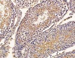 Invitrogen STK31 Polyclonal Antibody 100 &mu;L; Unconjugated:Antibodies,