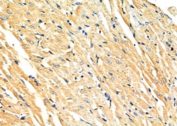 NEK4 Polyclonal Antibody:Antibodies, Polyclonal