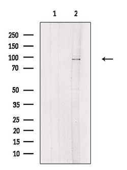 NEK4 Polyclonal Antibody:Antibodies, Polyclonal