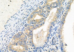 Invitrogen PIM2 Polyclonal Antibody 100 &mu;L; Unconjugated:Antibodies,