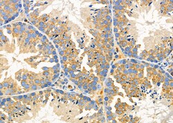Invitrogen PIM2 Polyclonal Antibody 100 &mu;L; Unconjugated:Antibodies,