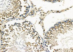 Invitrogen PIM2 Polyclonal Antibody 100 &mu;L; Unconjugated:Antibodies,