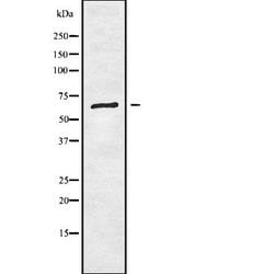 Invitrogen RIOK1 Polyclonal Antibody 100 &mu;L; Unconjugated:Antibodies,