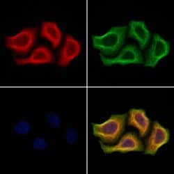 Invitrogen ULK4 Polyclonal Antibody 100 &mu;L | Buy Online | Invitrogen&trade; | Fisher Scientific