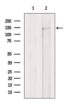 Invitrogen ULK4 Polyclonal Antibody 100 &mu;L | Buy Online | Invitrogen&trade; | Fisher Scientific