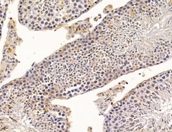 Invitrogen SCML2 Polyclonal Antibody 100 &mu;L; Unconjugated:Antibodies,