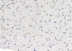 Invitrogen LNK Polyclonal Antibody 100 &mu;L | Buy Online | Invitrogen&trade; | Fisher Scientific