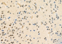 Invitrogen STAC3 Polyclonal Antibody 100 &mu;L; Unconjugated:Antibodies,