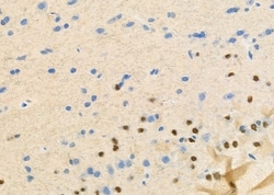 Invitrogen STAC3 Polyclonal Antibody 100 &mu;L; Unconjugated:Antibodies,