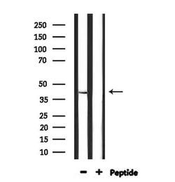 Invitrogen STAC3 Polyclonal Antibody 100 &mu;L; Unconjugated:Antibodies,