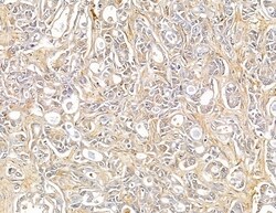 Invitrogen SH3PXD2A Polyclonal Antibody 100 &mu;L | Buy Online | Invitrogen&trade; | Fisher Scientific