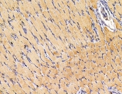 Invitrogen SH3PXD2A Polyclonal Antibody 100 &mu;L | Buy Online | Invitrogen&trade; | Fisher Scientific