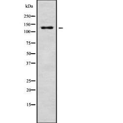 Invitrogen SH3PXD2A Polyclonal Antibody 100 &mu;L | Buy Online | Invitrogen&trade; | Fisher Scientific