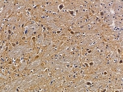 Invitrogen SH3TC2 Polyclonal Antibody 100 &mu;L; Unconjugated:Antibodies,