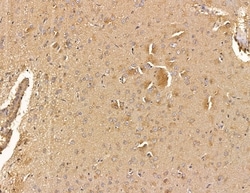 Invitrogen SH3BGRL Polyclonal Antibody 100 &mu;L; Unconjugated:Antibodies,