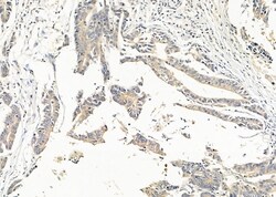 Invitrogen SLIT3 Polyclonal Antibody 100 &mu;L; Unconjugated:Antibodies,