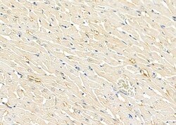 Invitrogen SLIT3 Polyclonal Antibody 100 &mu;L; Unconjugated:Antibodies,