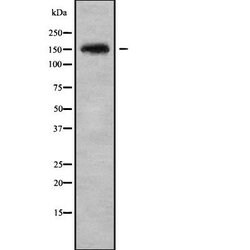 Invitrogen SLIT3 Polyclonal Antibody 100 &mu;L; Unconjugated:Antibodies,