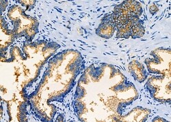 Invitrogen Eotaxin 3 Polyclonal Antibody 100 &mu;L; Unconjugated:Antibodies,