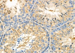 Invitrogen SLC6A13 Polyclonal Antibody 100 &mu;L; Unconjugated:Antibodies,