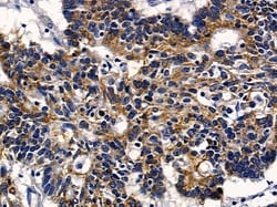 SLC6A14 Polyclonal Antibody, Invitrogen 100 &mu;L; Unconjugated:Antibodies,