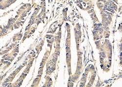 Invitrogen SLC4A7 Polyclonal Antibody 100 &mu;L; Unconjugated:Antibodies,