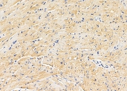 Invitrogen SLC4A7 Polyclonal Antibody 100 &mu;L; Unconjugated:Antibodies,