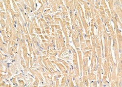 Invitrogen SLC4A7 Polyclonal Antibody 100 &mu;L; Unconjugated:Antibodies,