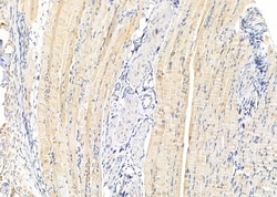 Invitrogen SLC4A7 Polyclonal Antibody 100 &mu;L; Unconjugated:Antibodies,