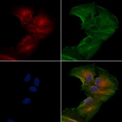 SCN11A Polyclonal Antibody:Antibodies, Polyclonal