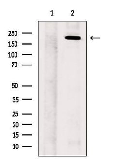 SCN11A Polyclonal Antibody:Antibodies, Polyclonal