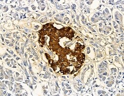 Invitrogen SLC10A4 Polyclonal Antibody 100 &mu;L; Unconjugated:Antibodies,