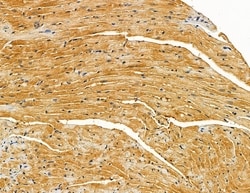 Invitrogen SLC10A4 Polyclonal Antibody 100 &mu;L; Unconjugated:Antibodies,